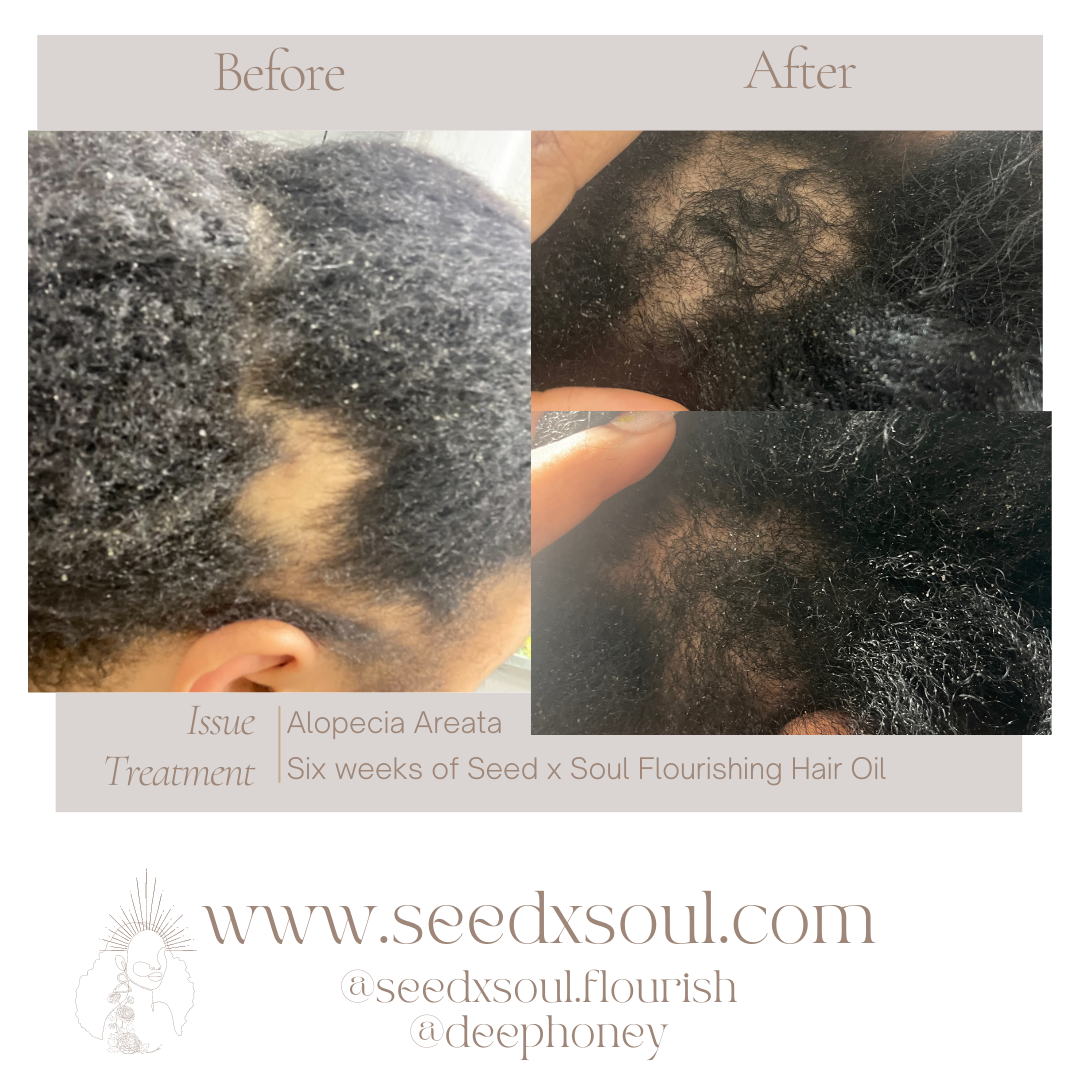 Seed x Soul Botanical Hair Growth Oil